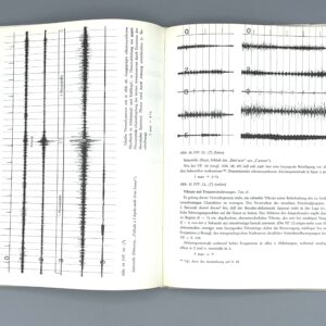 Used book – Das Vibrato unter besonderer Berücksichtigung der Verhältnisse bei Flötisten – GÄRTNER, Jochen - Image 7